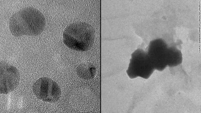 CNN公布最新研究：雾霾可以入脑导致老年痴呆 