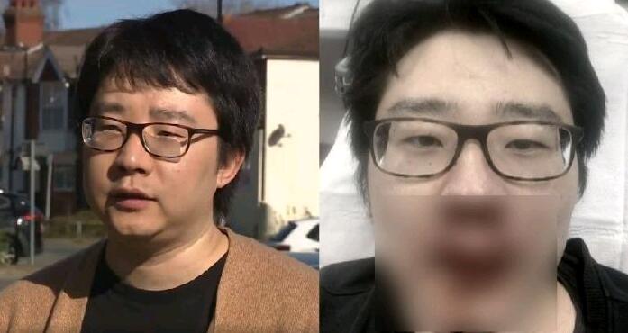 王鹏遇袭后受伤画面 王鹏遇袭后受伤画面