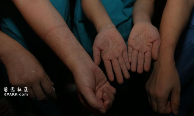 每天2万多入境人员广州隔离 广州疫情仍严峻